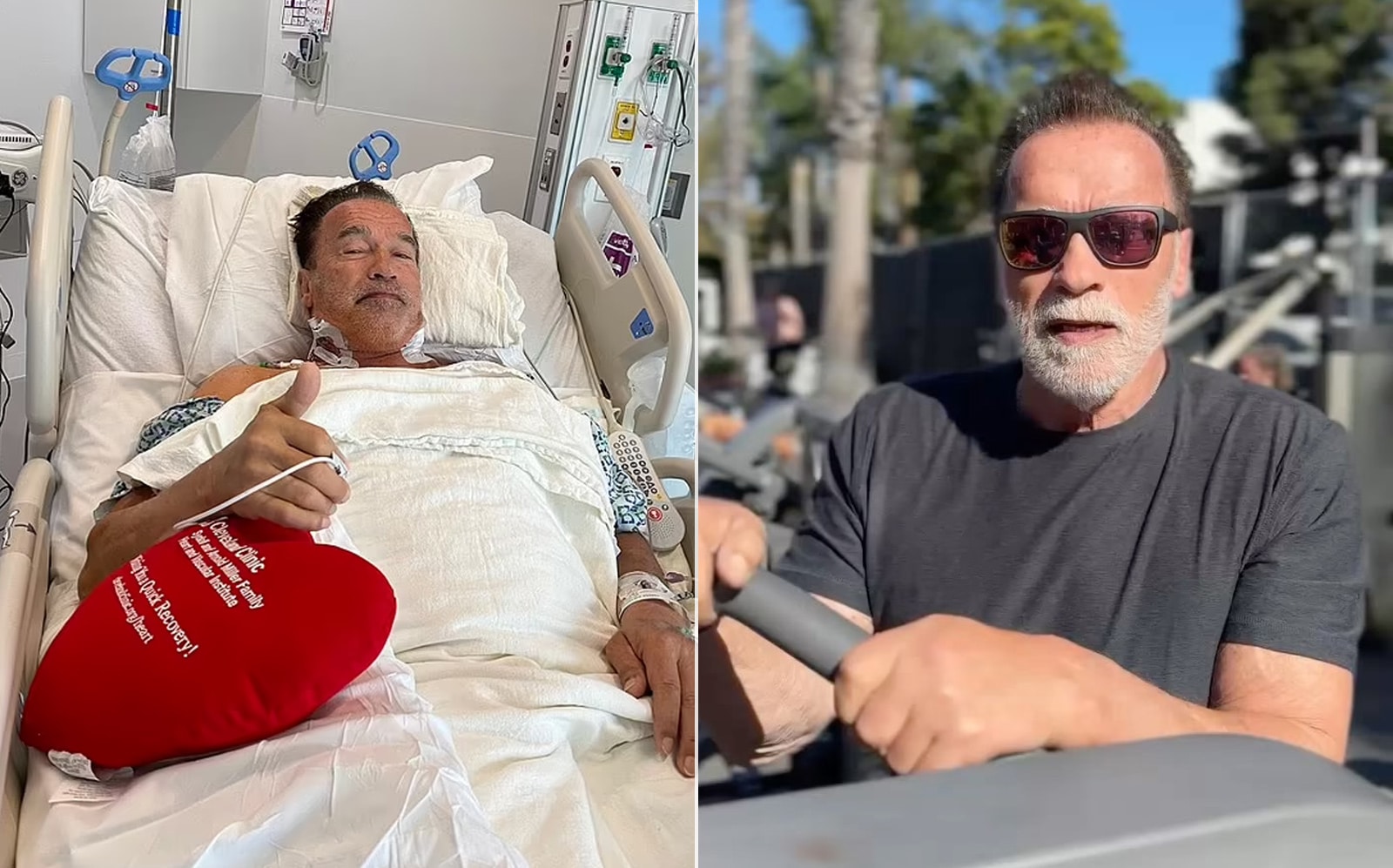 Arnold Schwarzenegger, 76 ans, subit une autre chirurgie cardiaque et reçoit un stimulateur cardiaque – Fitness Volt