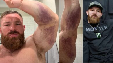 7x 212 Olympia Flex Lewis déchire le tendon du triceps de l'os dans un accident « anormal », dit qu'il aura besoin d'une intervention chirurgicale – Fitness Volt