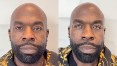 Le bodybuilder Kali Muscle subit une opération pour changer définitivement la couleur de ses yeux – Fitness Volt