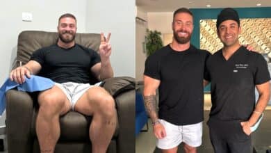 Chris Bumstead reçoit un « traitement de longévité » à base de cellules souches pour réduire l'inflammation et « ralentir le vieillissement du corps » – Fitness Volt